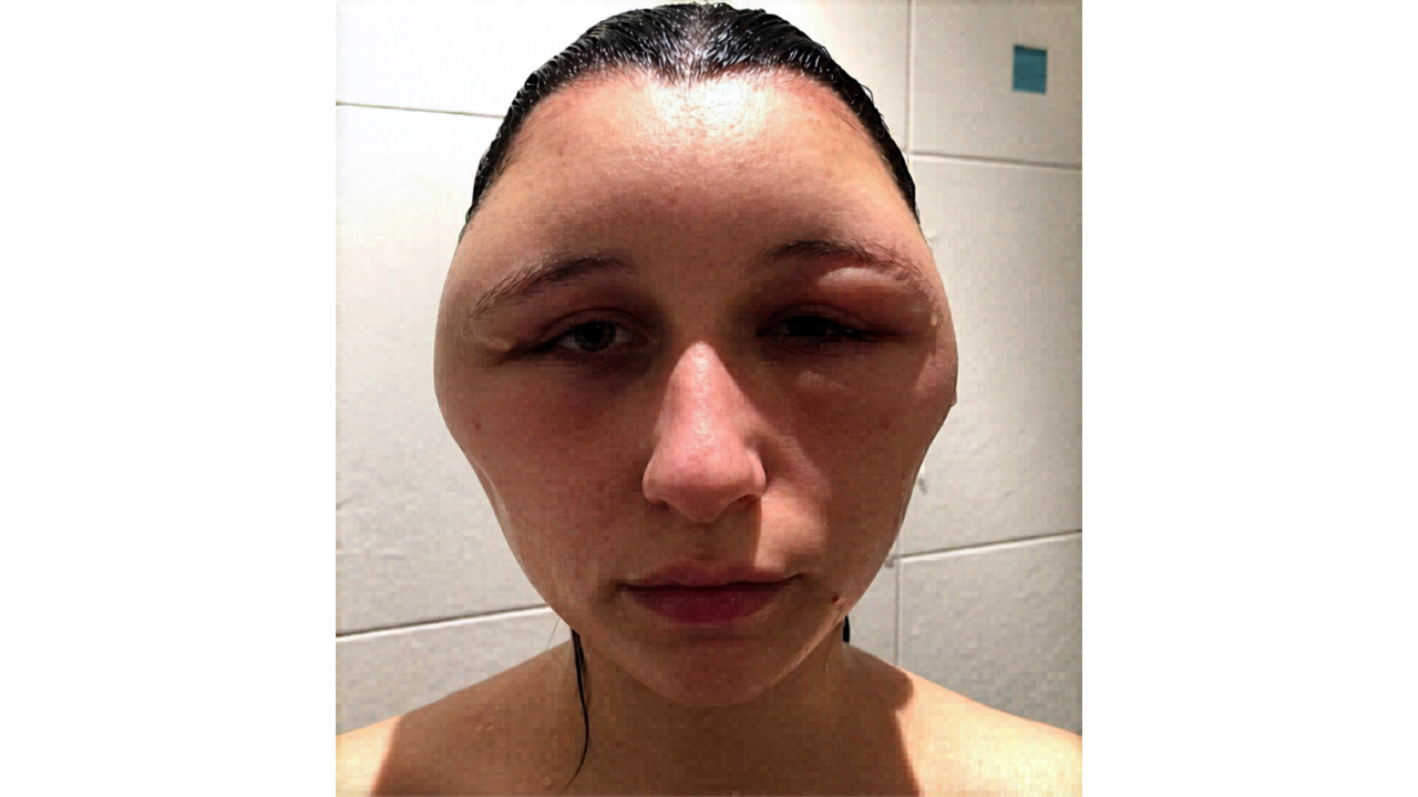 4. The Patch Test That Shouldn’t Be Skipped