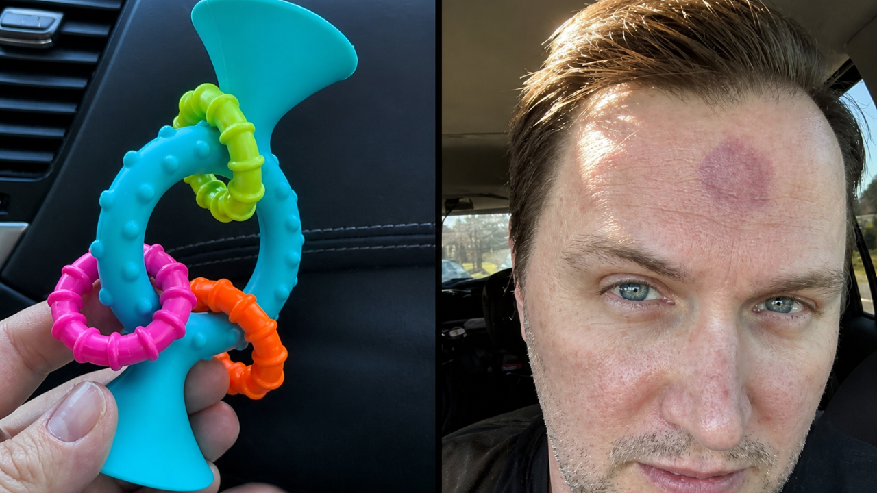 9. "Never Stick a Suction Toy to Your Head and Let Your Kid Pull on It"